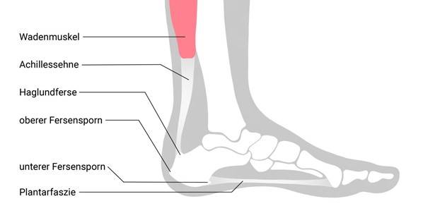 Schmerzen und ihre Ursachen: Achillessehnenentzündung